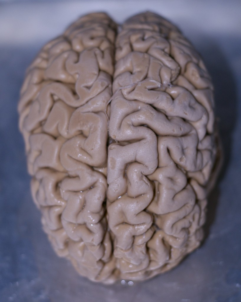 Picture of a brain
